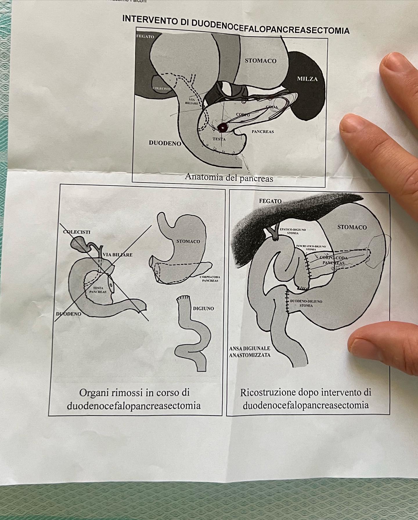 Fedez Settimana scorsa ho scoperto di avere un raro tumore neuroendocrino del pancreas...