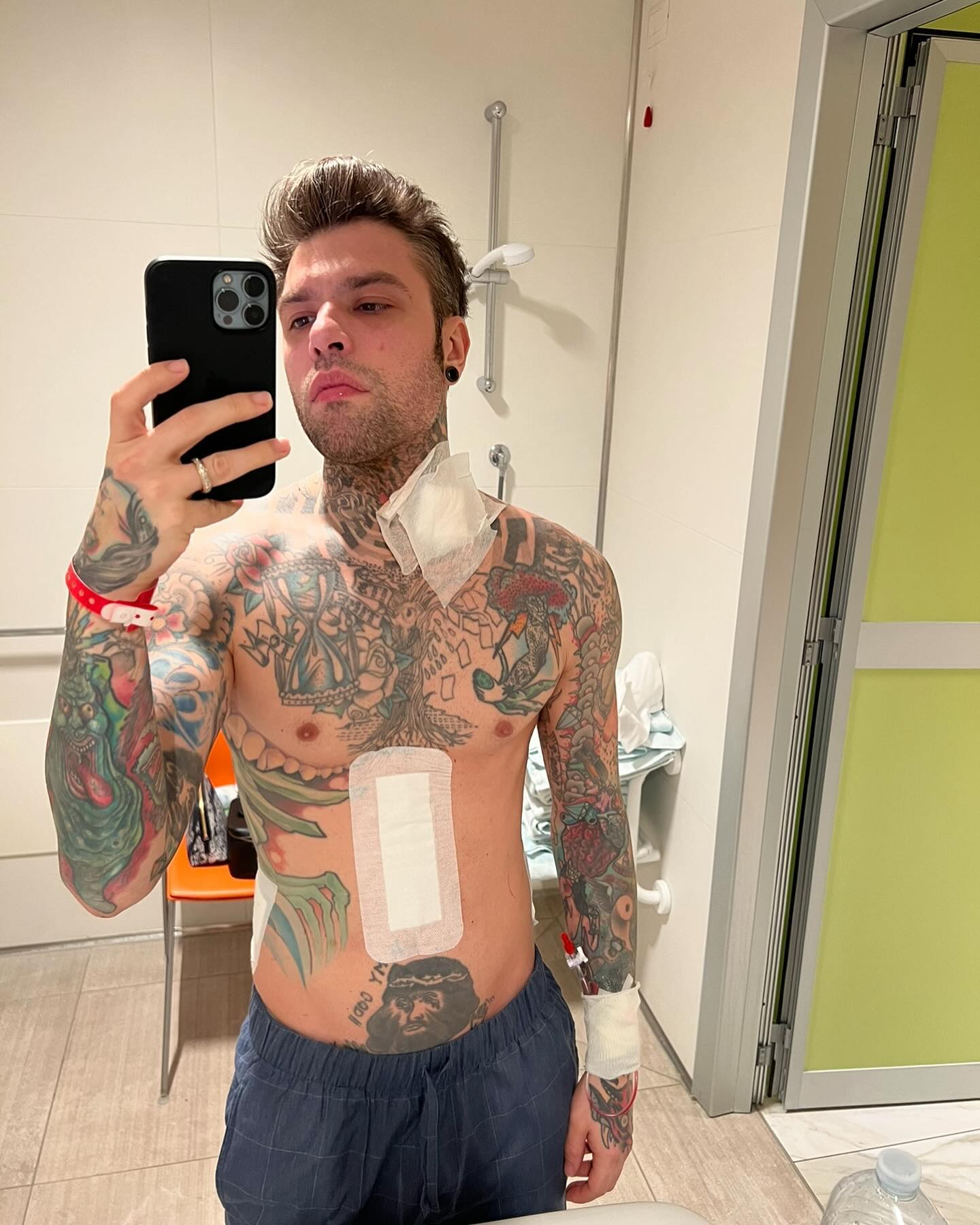 Fedez Esattamente 2 anni fa mi operavo di tumore al pancreas.
2 fottuti anni!
 La vita...