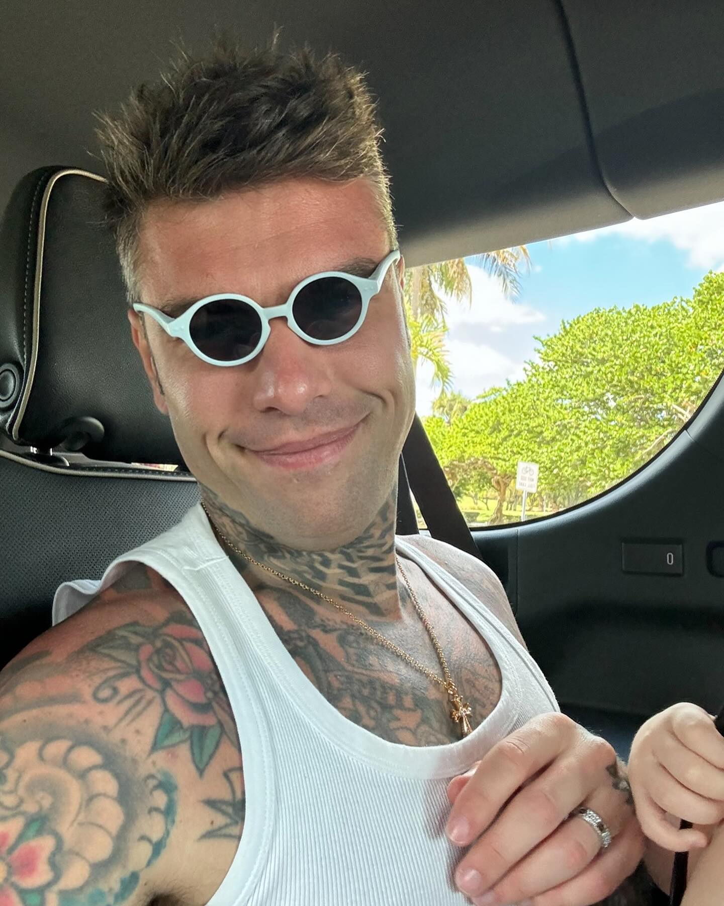 Fedez Ehi, questa è la maxi storia di come la mia vita è cambiata, capovolta sotto sop...